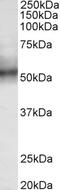 SRY-Box 11 antibody, 42-930, ProSci, Enzyme Linked Immunosorbent Assay image 