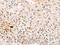 NADPH Oxidase 4 antibody, CSB-PA777165, Cusabio, Immunohistochemistry paraffin image 