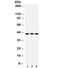 Ataxin 3 antibody, R32137, NSJ Bioreagents, Western Blot image 