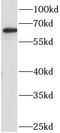 Acyloxyacyl Hydrolase antibody, FNab00453, FineTest, Western Blot image 