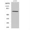 NADPH oxidase 3 antibody, A05715, Boster Biological Technology, Western Blot image 