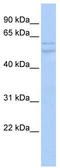 UDP-Glucuronate Decarboxylase 1 antibody, TA338694, Origene, Western Blot image 
