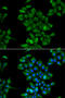 Cystinosin, Lysosomal Cystine Transporter antibody, STJ28973, St John