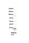 Ribosomal RNA Processing 1B antibody, 26-080, ProSci, Enzyme Linked Immunosorbent Assay image 