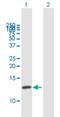 CDC28 Protein Kinase Regulatory Subunit 1B antibody, H00001163-B01P, Novus Biologicals, Western Blot image 
