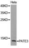 Prostate And Testis Expressed 3 antibody, LS-C192980, Lifespan Biosciences, Western Blot image 
