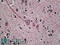 Transmembrane Serine Protease 4 antibody, 42-029, ProSci, Enzyme Linked Immunosorbent Assay image 