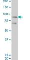 Lysine Acetyltransferase 2B antibody, H00008850-M06, Novus Biologicals, Western Blot image 