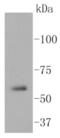 SRC Proto-Oncogene, Non-Receptor Tyrosine Kinase antibody, NBP2-67536, Novus Biologicals, Western Blot image 