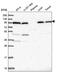 Coatomer Protein Complex Subunit Gamma 1 antibody, NBP2-58317, Novus Biologicals, Western Blot image 