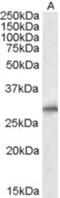Siah E3 Ubiquitin Protein Ligase 1 antibody, NB300-974, Novus Biologicals, Western Blot image 