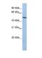 Lysyl Oxidase Like 1 antibody, ab81488, Abcam, Western Blot image 