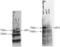 Chromobox 4 antibody, GTX24189, GeneTex, Western Blot image 
