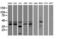 Sulfotransferase 1C2 antibody, M07212-1, Boster Biological Technology, Western Blot image 