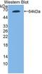 Toll Like Receptor 9 antibody, LS-C722158, Lifespan Biosciences, Western Blot image 