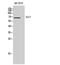 SLU7 Homolog, Splicing Factor antibody, PA5-51061, Invitrogen Antibodies, Western Blot image 