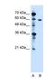 Zinc Finger DHHC-Type Containing 13 antibody, NBP1-59026, Novus Biologicals, Western Blot image 