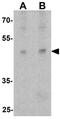 Autophagy Related 4A Cysteine Peptidase antibody, GTX31941, GeneTex, Western Blot image 