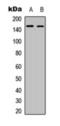 Colony Stimulating Factor 1 Receptor antibody, orb393257, Biorbyt, Western Blot image 