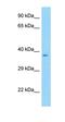 Lipin 2 antibody, orb331140, Biorbyt, Western Blot image 