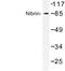 Nibrin antibody, LS-C176880, Lifespan Biosciences, Western Blot image 