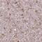 Inositol-Trisphosphate 3-Kinase A antibody, PA5-59185, Invitrogen Antibodies, Immunohistochemistry paraffin image 