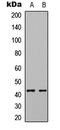 Epoxide Hydrolase 4 antibody, LS-B14361, Lifespan Biosciences, Western Blot image 