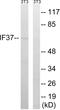 Eukaryotic Translation Initiation Factor 3 Subunit D antibody, LS-B5687, Lifespan Biosciences, Western Blot image 