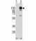 Platelet Derived Growth Factor Receptor Alpha antibody, F50656-0.4ML, NSJ Bioreagents, Western Blot image 