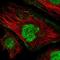 Troponin C1, Slow Skeletal And Cardiac Type antibody, NBP2-55151, Novus Biologicals, Immunofluorescence image 