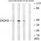 ZADH2 antibody, A13201, Boster Biological Technology, Western Blot image 