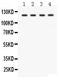 Solute Carrier Family 12 Member 1 antibody, LS-C357580, Lifespan Biosciences, Western Blot image 