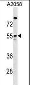 Rho GTPase Activating Protein 1 antibody, LS-C159106, Lifespan Biosciences, Western Blot image 