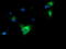 Haptoglobin antibody, LS-C115621, Lifespan Biosciences, Immunofluorescence image 