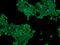 Protein Phosphatase, Mg2+/Mn2+ Dependent 1D antibody, 205752-T02, Sino Biological, Immunohistochemistry paraffin image 