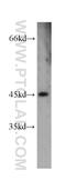 GDNF Family Receptor Alpha 2 antibody, 55038-1-AP, Proteintech Group, Western Blot image 