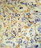 Fibrinogen Alpha Chain antibody, LS-C166124, Lifespan Biosciences, Immunohistochemistry frozen image 
