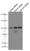 Ubiquitin Specific Peptidase 5 antibody, 66213-1-Ig, Proteintech Group, Western Blot image 