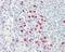 ATP Binding Cassette Subfamily G Member 2 (Junior Blood Group) antibody, GTX100436, GeneTex, Immunohistochemistry paraffin image 
