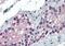Forkhead Box E1 antibody, NB100-1271, Novus Biologicals, Immunohistochemistry frozen image 