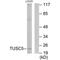 Trafficking Regulator Of GLUT4 (SLC2A4) 1 antibody, PA5-49848, Invitrogen Antibodies, Western Blot image 