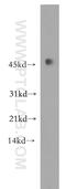 V-Set Pre-B Cell Surrogate Light Chain 3 antibody, 11915-1-AP, Proteintech Group, Western Blot image 