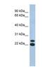 Chromosome 19 Open Reading Frame 54 antibody, NBP1-91469, Novus Biologicals, Western Blot image 