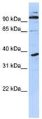 PHD Finger Protein 11 antibody, TA345190, Origene, Western Blot image 