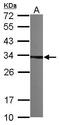 Tubulin Folding Cofactor B antibody, TA308037, Origene, Western Blot image 