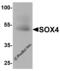 SRY-Box 4 antibody, 8123, ProSci, Western Blot image 