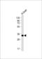 Glycine N-Methyltransferase antibody, MA5-24759, Invitrogen Antibodies, Western Blot image 