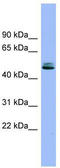 Serine Peptidase Inhibitor, Kunitz Type 1 antibody, TA336031, Origene, Western Blot image 