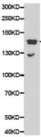 NCOA1 antibody, TA321591, Origene, Western Blot image 