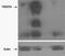 Tankyrase-1 antibody, GTX88517, GeneTex, Western Blot image 